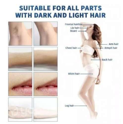 Máquina de depilación láser Diodo nueva