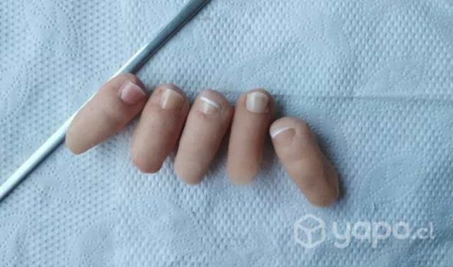 Prótesis Estéticas Dedos, pies, manos