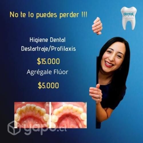 Higiene dental
