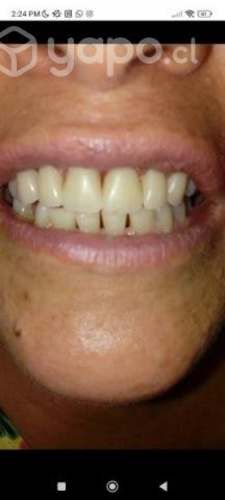 Laboratorista dental a domicilio