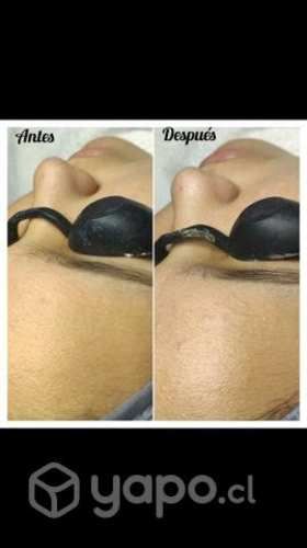 Spa facial a domicilio