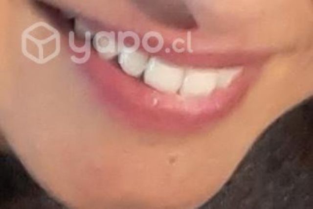 LIMPIEZA DENTAL CON ULTRASONIDO  PROMOCION