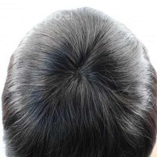 Prótesis capilar (9x7 cm) Reemplazo de cabello hum