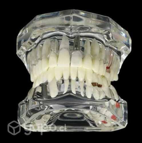 Modelo de dientes interactivo