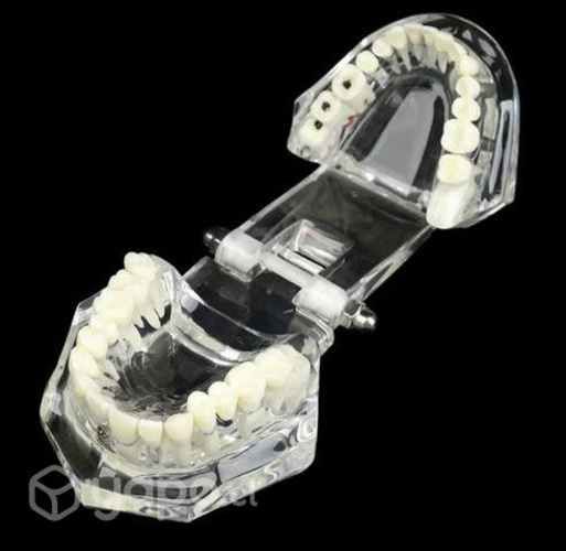 Modelo de dientes interactivo