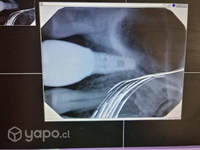 Sensor rayos x dental dexis