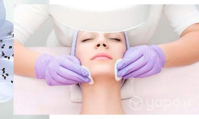 Limpieza facial Profunda 1 sesión 35.000 pack 4