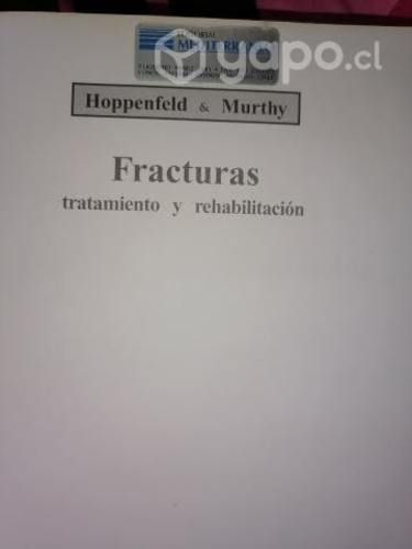 Fracturas Tratamiento y Rehabilitacion
