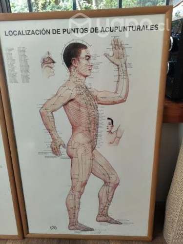 Cuadros ilustrativos de acupuntura a