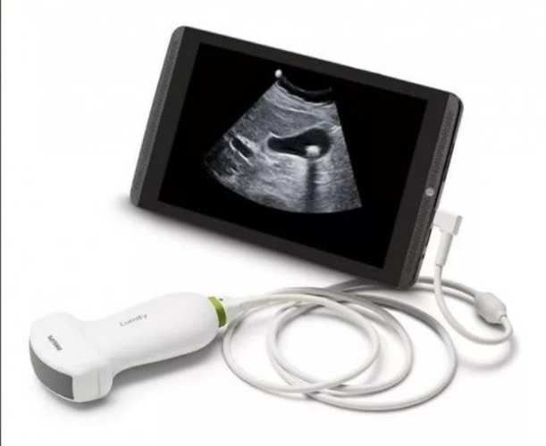 EcÓgrafo Lumify Portatil