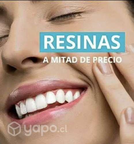 Tapaduras dental