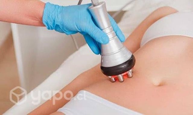 Maquina de cavitación 5 en 1