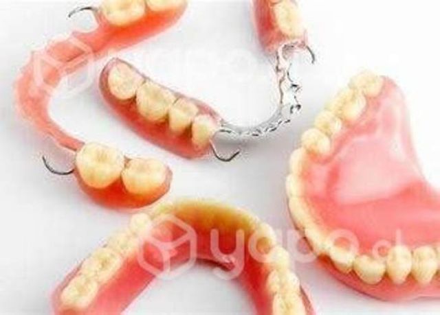 Reparación de prótesis dentales a domicilio, Biobí