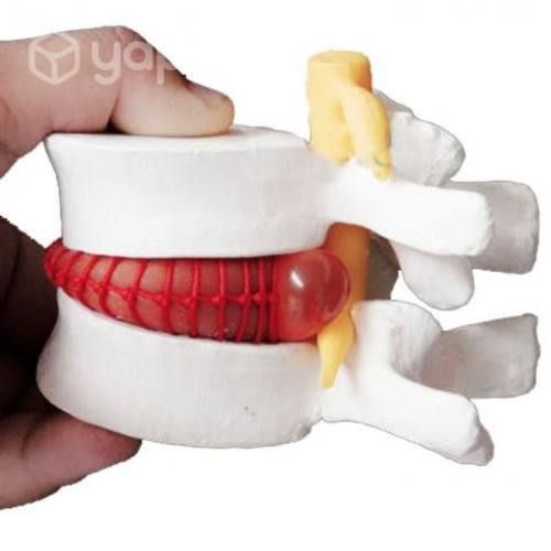 Modelo Anatómico Disco Lumbar Espina Dorsal
