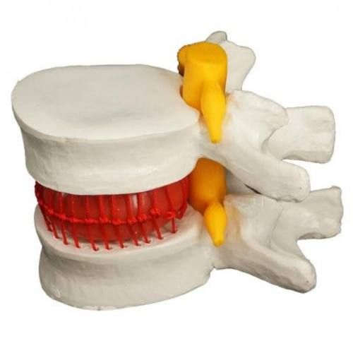 Modelo Anatómico Disco Lumbar Espina Dorsal