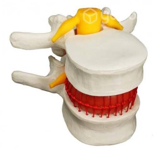 Modelo Anatómico Disco Lumbar Espina Dorsal