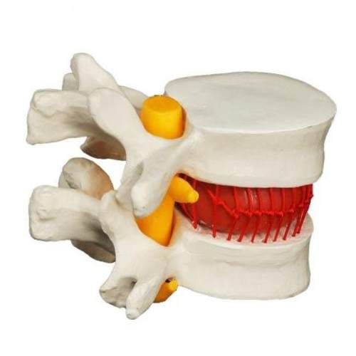 Modelo Anatómico Disco Lumbar Espina Dorsal