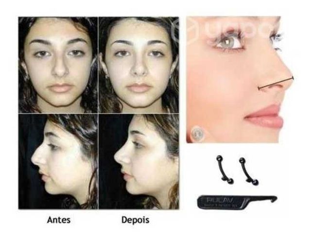 Par Respingador Nariz de Silicona