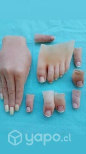 Prótesis Estéticas