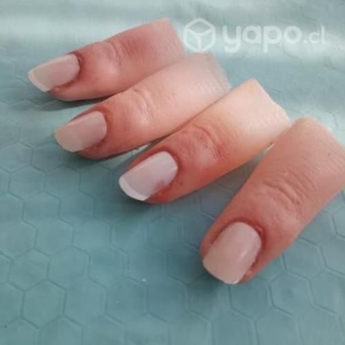 Prótesis Estéticas