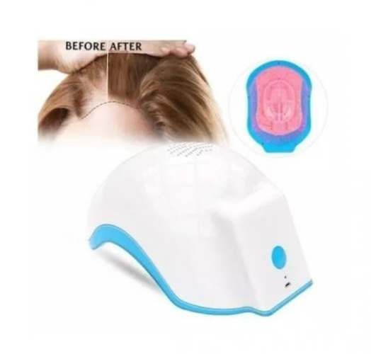 Tratamiento 80 Diodos Crecimiento Cabello