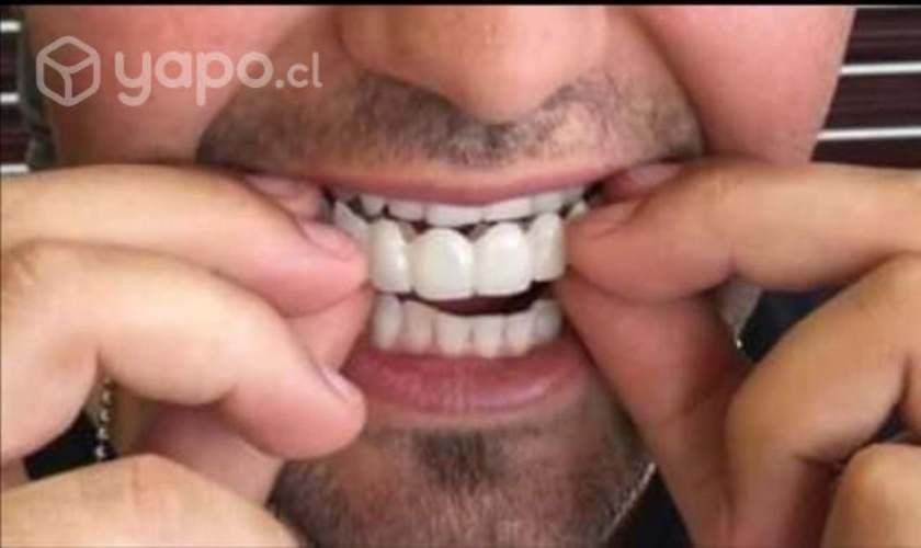 Fundas de Silicon Arriba y Abajo*