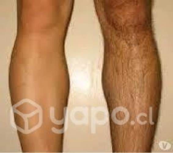 Depilación unisex San Miguel