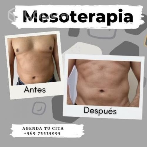 Elimina grasa localizada