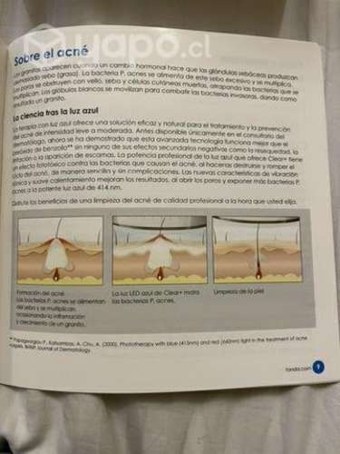 Tratamiento para acné