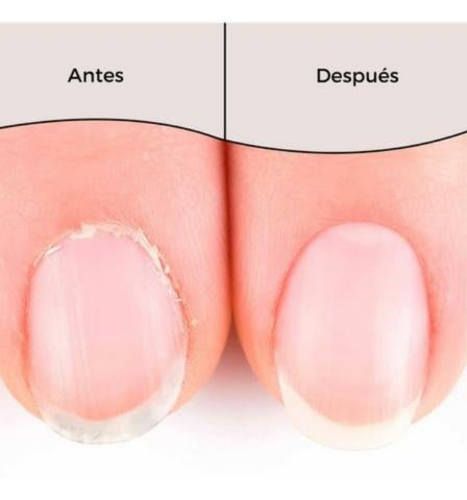 Aceite de cutículas