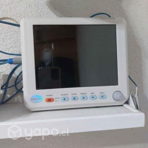 Monitor multiparametros