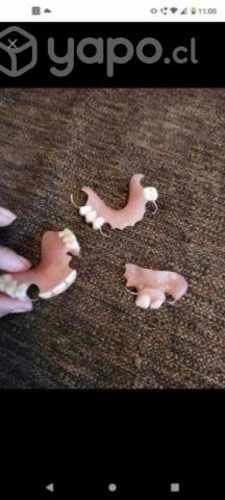 Prótesis desde una pieza dental