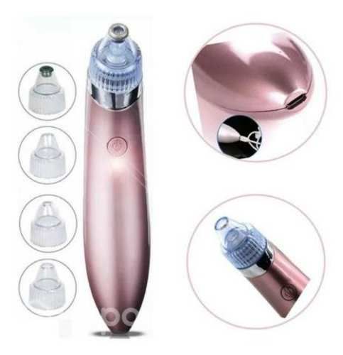 Extractor de puntos negros