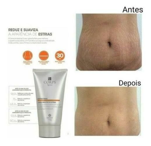 Reduce las estrías (ANTIESTRIAS )