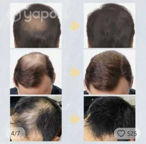 Producto de Belleza capilar