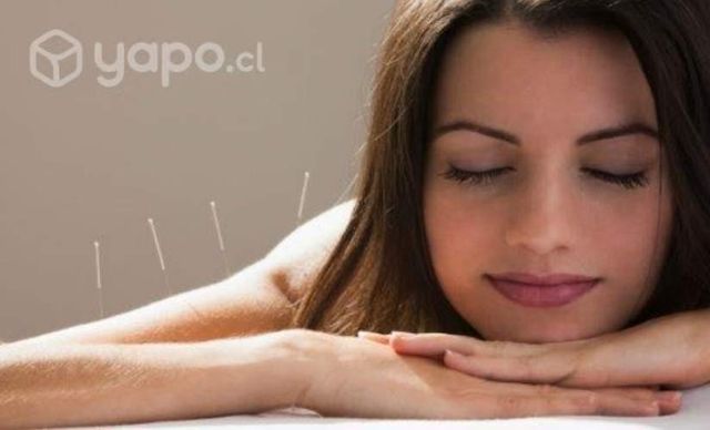 Acupuntura en Talca Acreditado por Minsal