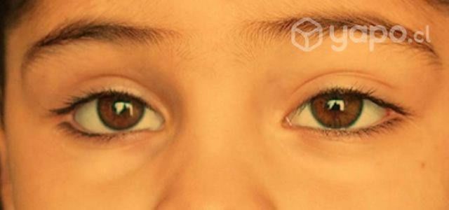 Ojos de acrílico PMMA (prótesis oculares)