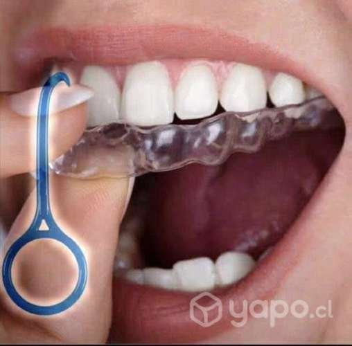 Removedor y posicionador de alineadores dentales