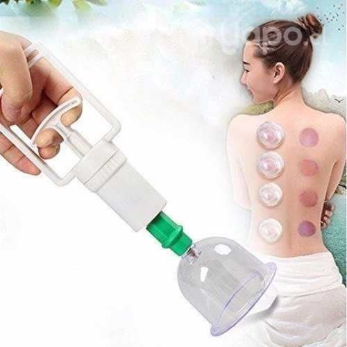 6 Copas Ventosas Tecnica China + Manguera