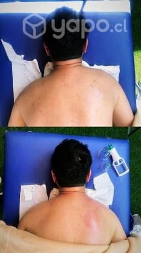 Masajes terapéuticos