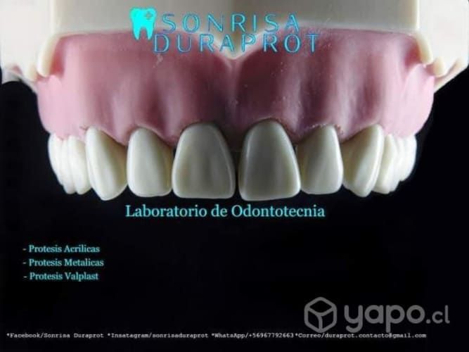 Prótesis dental removibles