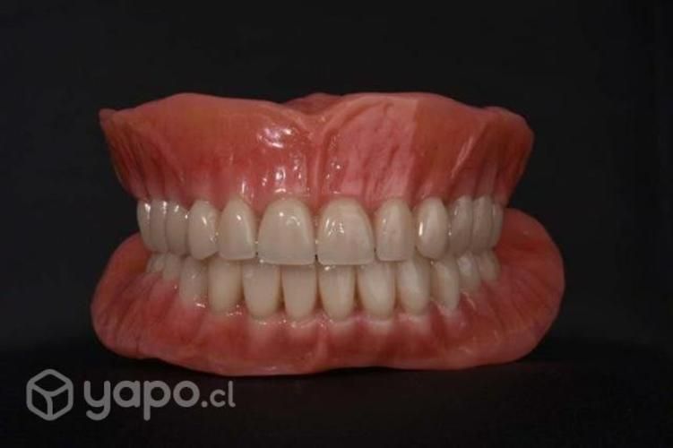 Prótesis dental removibles