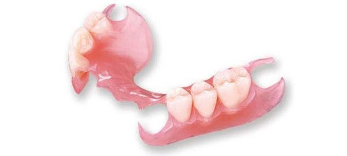 Prótesis dental removibles