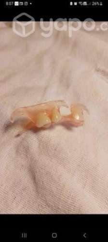 Reparación de prótesis dentales