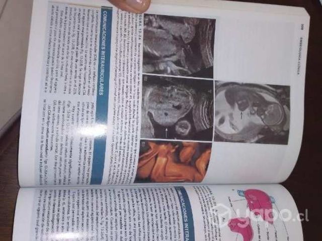 Libro embriología clínica