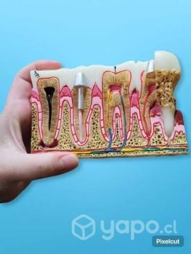 Macromodelo educativo dental