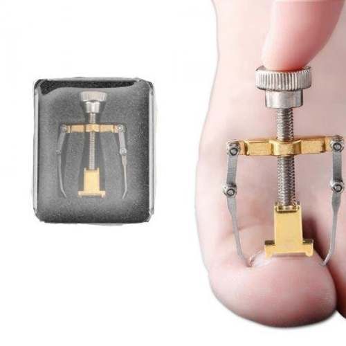 Dispositivo Para Corrección De Uñas Encarnadas