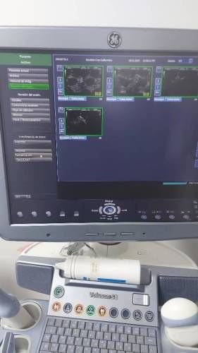 Ecografo Voluson S8 2014 con refurbish 2019