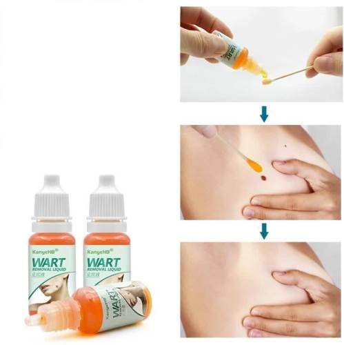 Crema Elimina Verrugas, Herpes Genital, Vulva, Condyloma