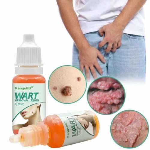 Crema Elimina Verrugas, Herpes Genital, Vulva, Condyloma